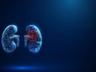 5 Makanan yang Perlu Dibatasi Agar Ginjal Sehat