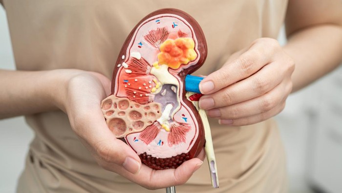 4 Jenis Minuman yang Diam-diam Merusak Ginjal