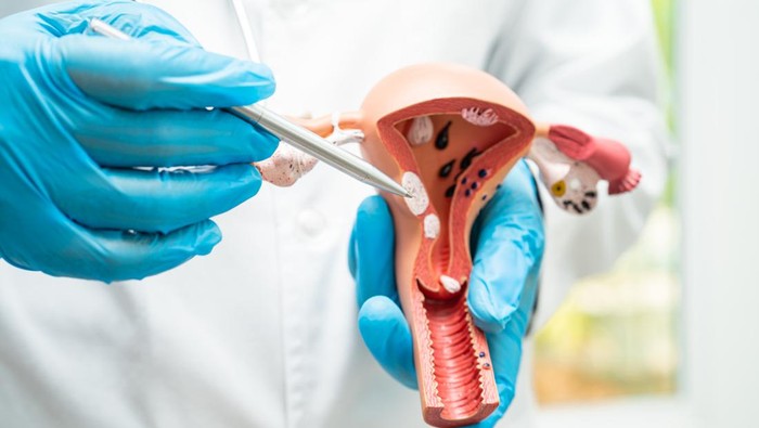 Gangguan Rahim yang Bikin Sulit Hamil, Padahal Siklus Menstruasi Normal