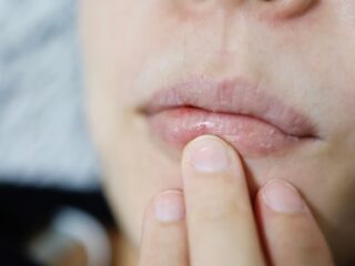 Kedutan Bibir Bawah: Penyebab, Mitos, dan Cara Mengatasinya