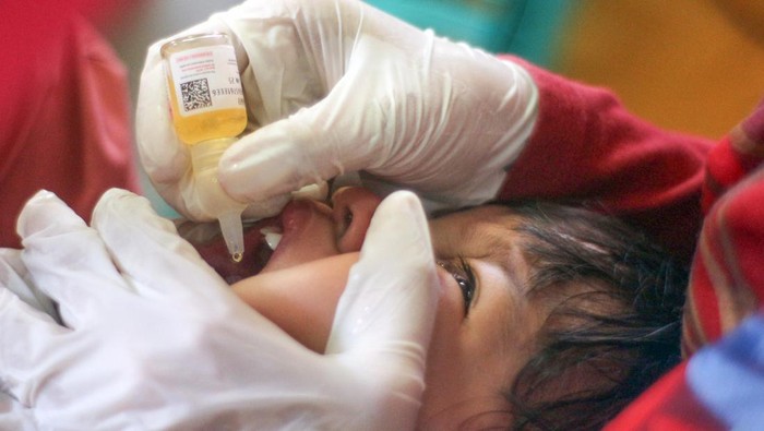 Indonesia Resmi Akhiri KLB Polio Tipe 2, WHO Nyatakan Situasi Terkendalia