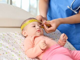 Ciri Kepala Bayi Sehat dan Tidak Sehat