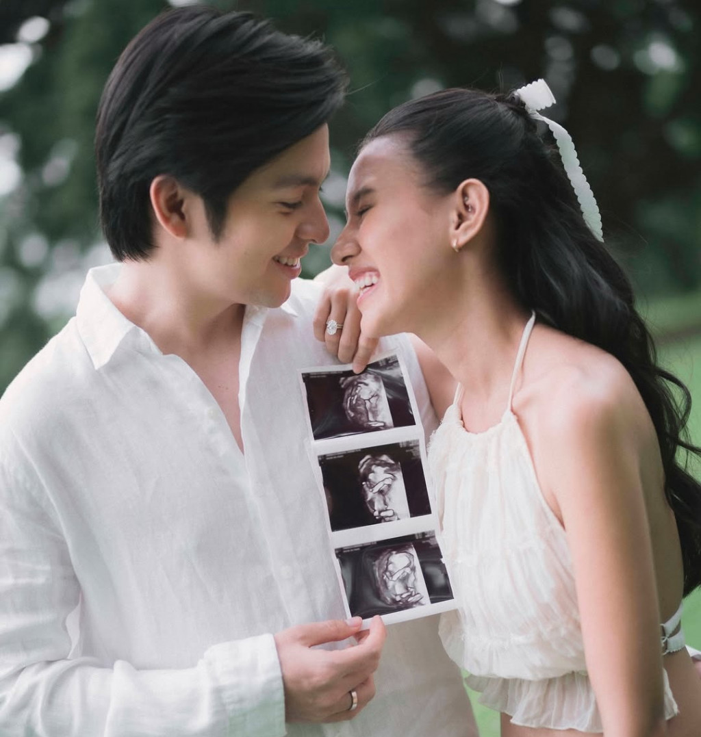 Angga Yunanda dan Shenina Cinnamon Umumkan Kehamilan di Anniversary Pertama