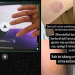 Penumpang Soroti Tanggung Jawab Travel SM Usai Kecelakaan di Pesisir Selatan