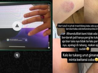 Penumpang Soroti Tanggung Jawab Travel SM Usai Kecelakaan di Pesisir Selatan