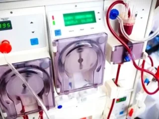 Cuci Darah (Hemodialisis): Fungsi, Prosedur, dan Hal Penting yang Perlu Diketahui