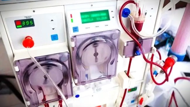 Cuci Darah (Hemodialisis): Fungsi, Prosedur, dan Hal Penting yang Perlu Diketahui