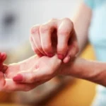 Telapak Tangan Kiri Gatal? Ini Penyebab Medis dan Cara Mengatasinya