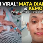 Kisah Tegar Rizki Melawan Kanker Mata: "Saya Tetap Semangat untuk Sembuh"