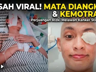 Kisah Tegar Rizki Melawan Kanker Mata: "Saya Tetap Semangat untuk Sembuh"