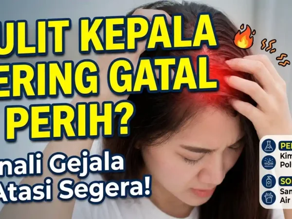 Cara Mengatasi Kulit Kepala Sensitif agar Rambut Tetap Sehat