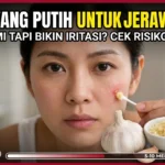 Cara Aman Pakai Bawang Putih untuk Jerawat agar Kulit Tak Iritasi