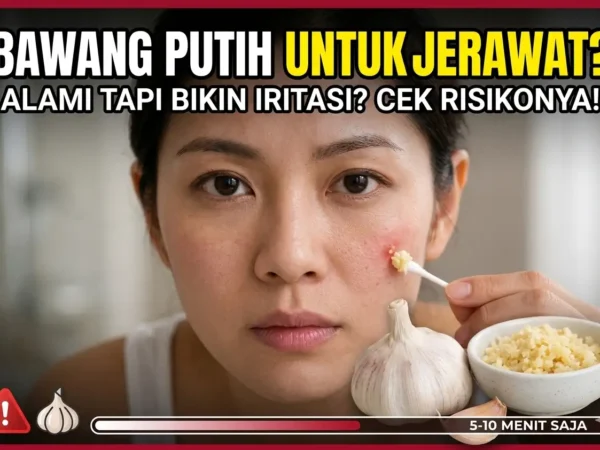 Cara Aman Pakai Bawang Putih untuk Jerawat agar Kulit Tak Iritasi