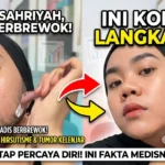 Perjuangan Sahriyah: Lawan Tumor Kelenjar di Balik Fenomena Brewok Unik pada Wajahnya