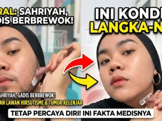 Perjuangan Sahriyah: Lawan Tumor Kelenjar di Balik Fenomena Brewok Unik pada Wajahnya