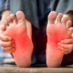 Ini 9 Cara Mudah Mengatasi Kaki Kesemutan dan Penyebabnya